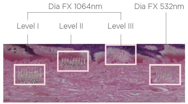 DIA FX handstukken getest op een kristal